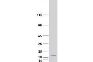 Western Blotting (WB) image for Multiple Coagulation Factor Deficiency 2 (MCFD2) protein (Myc-DYKDDDDK Tag) (ABIN2725609)