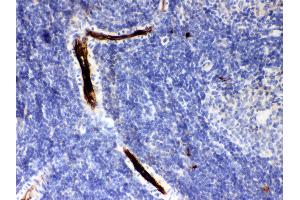 Immunohistochemistry (IHC) image for anti-serpin Peptidase Inhibitor, Clade A (Alpha-1 Antiproteinase, Antitrypsin), Member 1 (SERPINA1) (AA 211-411) antibody (ABIN3043431)