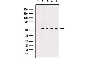 Western blot analysis of extracts from various samples, using PDHX Antibody. (PDHX 抗体)
