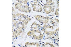 Immunohistochemistry of paraffin-embedded human stomach using SCG3 antibody. (SCG3 抗体  (AA 199-468))
