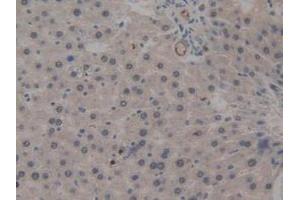 IHC-P analysis of Rat Liver Tissue, with DAB staining. (ICAM2 抗体  (AA 29-247))