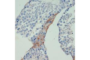 Immunohistochemistry of paraffin-embedded mouse testis using KIF5B antibody (ABIN7268136) at dilution of 1:200 (40x lens). (KIF5B 抗体  (AA 650-770))