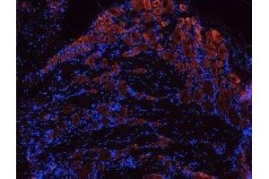 Immunohistochemistry (IHC) image for anti-Neurotrophic Tyrosine Kinase, Receptor, Type 2 (NTRK2) (AA 57-70), (Extracellular) antibody (ABIN7043388)