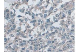 Immunohistochemistry (IHC) image for anti-Myosin Heavy Chain 7, Cardiac Muscle, beta (MYH7) (AA 26-309) antibody (ABIN7440755)