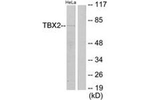 Western blot analysis of extracts from HeLa cells, using TBX2 Antibody. (TBX2 抗体  (AA 251-300))