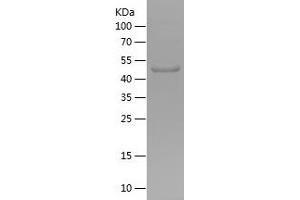 Western Blotting (WB) image for Fucosyltransferase 6 (Alpha (1,3) Fucosyltransferase) (FUT6) (AA 111-332) protein (His-IF2DI Tag) (ABIN7123013) (FUT6 Protein (AA 111-332) (His-IF2DI Tag))