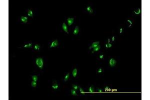Immunofluorescence of purified MaxPab antibody to GOLGA1 on HeLa cell. (GOLGA1 抗体  (AA 1-767))