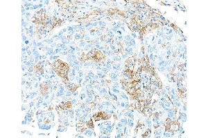 Immunohistochemistry (IHC) image for anti-CD16 (CD16) (AA 21-201) antibody (ABIN7449423)