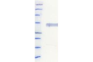 Western Blotting (WB) image for anti-His Tag antibody (ABIN6252928) (His Tag 抗体)