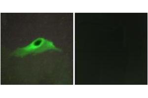 Immunofluorescence analysis of HeLa cells, using Collagen IV alpha5 Antibody. (COL4a5 抗体  (AA 21-70))