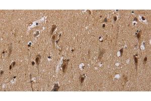 Immunohistochemistry of paraffin-embedded Human brain using GTF2I Polyclonal Antibody at dilution of 1:40 (GTF2I 抗体)