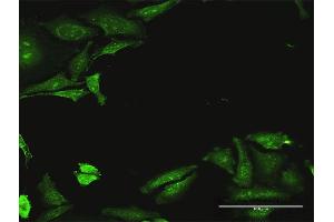 Immunofluorescence of purified MaxPab antibody to CDADC1 on HeLa cell. (CDADC1 抗体  (AA 1-514))