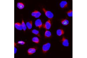 IF analysis of BubR1/BUB1B using anti-BubR1/BUB1B antibody (ABIN7600962). (BUB1B 抗体  (AA 26-448))