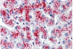 Human Liver (formalin-fixed, paraffin-embedded) stained with  antibody ABIN462271 followed by biotinylated secondary antibody, alkaline phosphatase-streptavidin and chromogen. (RNH1 抗体  (AA 7-461))