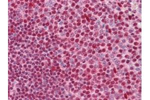 Immunohistochemistry (IHC) image for anti-Cut-Like Homeobox 1 (CUX1) (AA 521-621) antibody (ABIN614596) (CUX1 抗体  (AA 521-621))