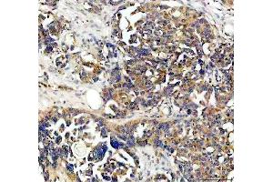 IHC analysis of NQO1 using anti-NQO1 antibody (ABIN7599200).