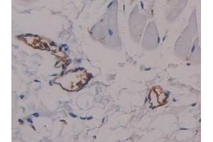 #VALUE! (alpha Fetoprotein 抗体  (AA 409-611))