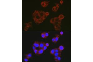 Immunofluorescence (IF) image for anti-Complement Factor H (CFH) (AA 20-270) antibody (ABIN3023097)