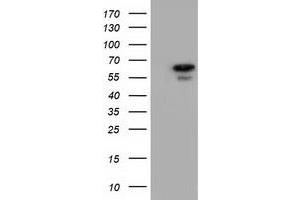 Image no. 6 for anti-Adenylate Kinase 5 (AK5) antibody (ABIN1496535) (Adenylate Kinase 5 抗体)