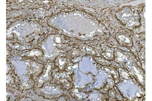 IHC analysis of EHD3 using anti-EHD3 antibody (ABIN7602777). (EHD3 抗体  (C-Term))