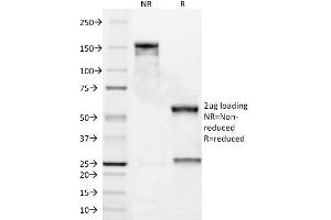 SDS-PAGE Analysis Purified Bcl-2 Mouse Monoclonal Antibody (8C8). (Bcl-2 抗体  (AA 41-54))
