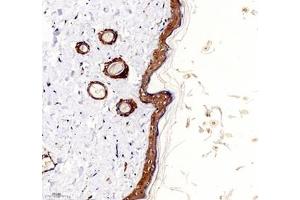 Immunohistochemistry (Paraffin-embedded Sections) (IHC (p)) image for anti-Palladin, Cytoskeletal Associated Protein (PALLD) antibody (ABIN7074976)