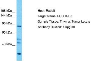 Host: Rabbit Target Name: PCDHGB5 Sample Type: Thymus Tumor lysates Antibody Dilution: 1. (PCDHGB5 抗体  (Middle Region))