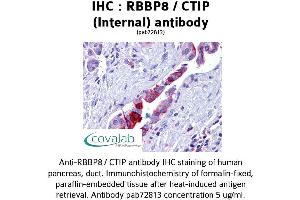 Image no. 3 for anti-Retinoblastoma Binding Protein 8 (RBBP8) (Internal Region) antibody (ABIN1738768) (Retinoblastoma Binding Protein 8 抗体  (Internal Region))
