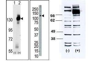 (LEFT) Western blot analysis of CSF1R (arrow) using rabbit polyclonal CSF1R Antibody (C-term). (CSF1R 抗体  (C-Term))