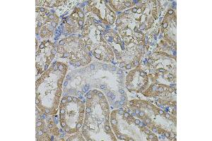 Immunohistochemistry of paraffin-embedded mouse kidney using MMP9 antibody (ABIN4904399) at dilution of 1:100 (40x lens). (MMP 9 抗体)