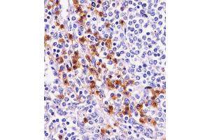 Antibody staining D11b in human spleen tissue sections by Immunohistochemistry (IHC-P - paraformaldehyde-fixed, paraffin-embedded sections). (CD11b 抗体  (N-Term))