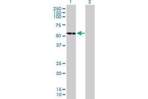 Western Blot analysis of CPB2 expression in transfected 293T cell line by CPB2 MaxPab polyclonal antibody. (CPB2 抗体  (AA 1-423))