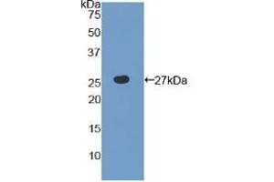 Western blot analysis of recombinant Human TLR6. (TLR6 抗体  (AA 608-796))