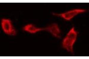 ABIN6269143 staining NIH-3T3 by IF/ICC. (Glycogen Synthase 1 抗体  (C-Term))