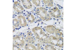 Immunohistochemistry of paraffin-embedded human gastric using ST8SIA2 antibody at dilution of 1:100 (x40 lens). (ST8SIA2 抗体)