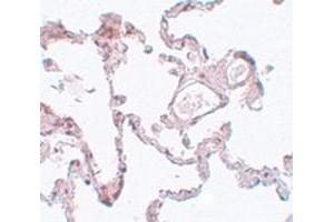 Immunohistochemical staining of hman lung tissue with PLEKHM1 polyclonal antibody  at 5 ug/mL dilution. (PLEKHM1 抗体  (N-Term))