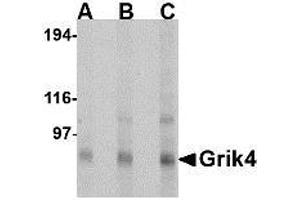 Image no. 1 for anti-Glutamate Receptor, Ionotropic, Kainate 4 (GRIK4) (N-Term) antibody (ABIN1494379) (GRIK4 抗体  (N-Term))