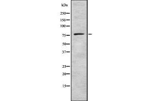 Western blot analysis GCS alpha-1 using LOVO whole cell lysates (GUCY1A1 抗体  (C-Term))