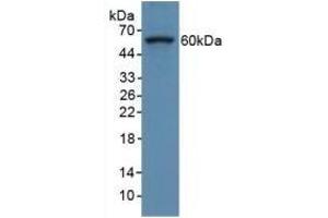 Western Blotting (WB) image for anti-Collagen, Type VIII, alpha 1 (COL8A1) (AA 590-744) antibody (ABIN7437539)