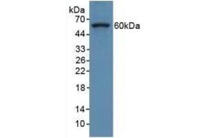 Detection of COL8a1 in Human Hela Cells using Polyclonal Antibody to Collagen Type VIII Alpha 1 (COL8a1) (COL8A1 抗体  (AA 590-744))