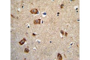 IHC analysis of FFPE human brain tissue stained with Integrin alpha 1 antibody (Integrin alpha 1 抗体  (AA 727-755))