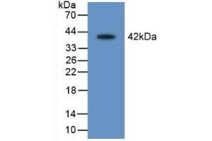 Detection of Recombinant LEI, Rat using Polyclonal Antibody to Leukocyte Elastase Inhibitor (LEI) (SERPINB1 抗体  (AA 17-332))