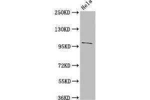 Western Blot Positive WB detected in: Hela whole cell lysate All lanes: NPC1 antibody at 3 μg/mL Secondary Goat polyclonal to rabbit IgG at 1/50000 dilution Predicted band size: 143, 108 kDa Observed band size: 108 kDa (NPC1 抗体  (AA 23-269))