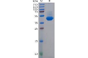 SDS-PAGE (SDS) image for Poliovirus Receptor-Related 4 (PVRL4) (AA 32-349) protein (His tag) (ABIN6964194)