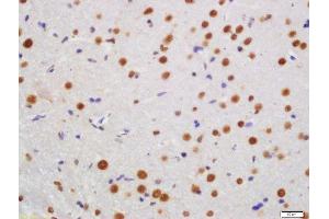 Formalin-fixed and paraffin embedded rat brain labeled with Rabbit Anti-KLHL7 Polyclonal Antibody, Unconjugated (ABIN760046) at 1:200 followed by conjugation to the secondary antibody and DAB staining (KLHL7 抗体  (AA 51-150))