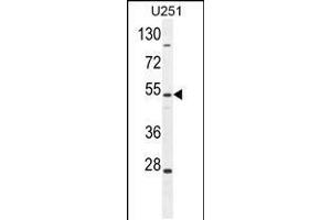 Western blot analysis in U251 cell line lysates (35ug/lane). (ZIK1 抗体  (AA 186-215))