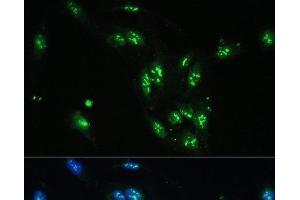 Immunofluorescence analysis of U-2 OS cells using CCDC59 Polyclonal Antibody at dilution of 1:100. (CCDC59 抗体)