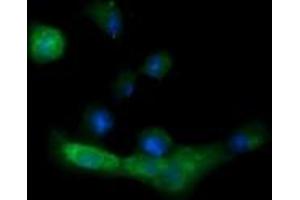 Image no. 5 for anti-Melan A (MLANA) antibody (ABIN1499424) (MLANA 抗体)