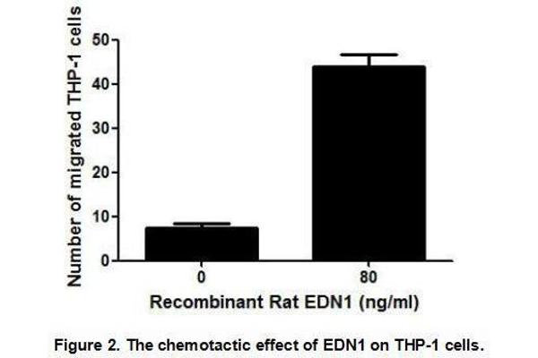 Endothelin 1 Protein (EDN1) (AA 54-202) (His tag)