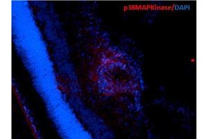 Immunohistochemistry analysis using Mouse Anti-p38 MAPK Monoclonal Antibody, Clone 9F12 . (MAPK14 抗体  (HRP))